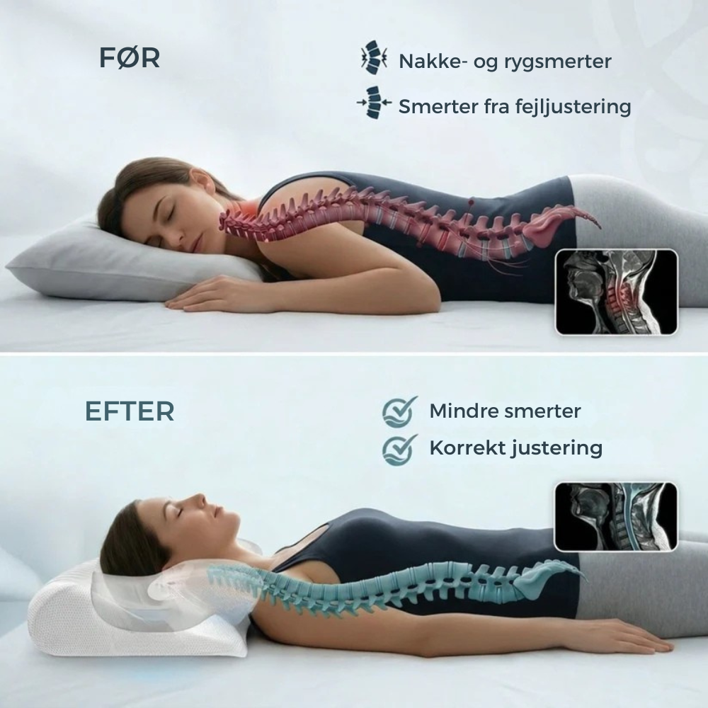Restora™ | Ergonomisk nackkudde i memoryskum